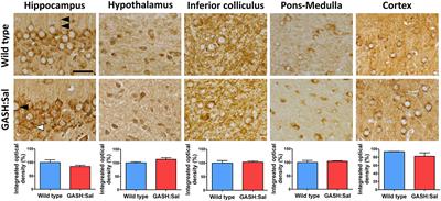 Seizures regulate the cation-Cl− cotransporter NKCC1 in a hamster model of epilepsy: implications for GABA neurotransmission